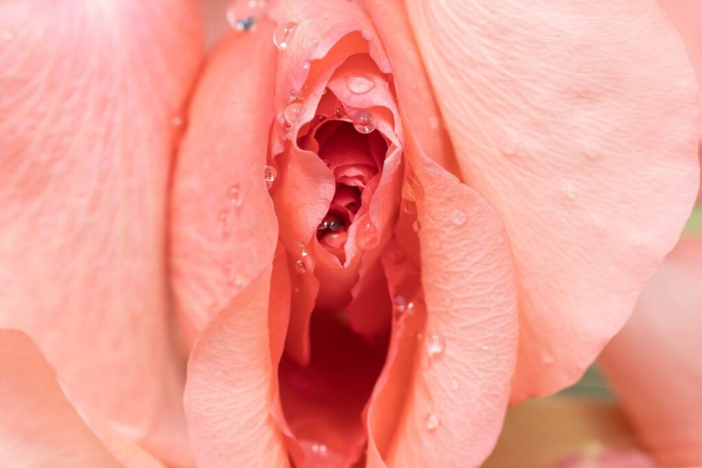 cosmetic labiaplasty