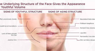 Sculptra