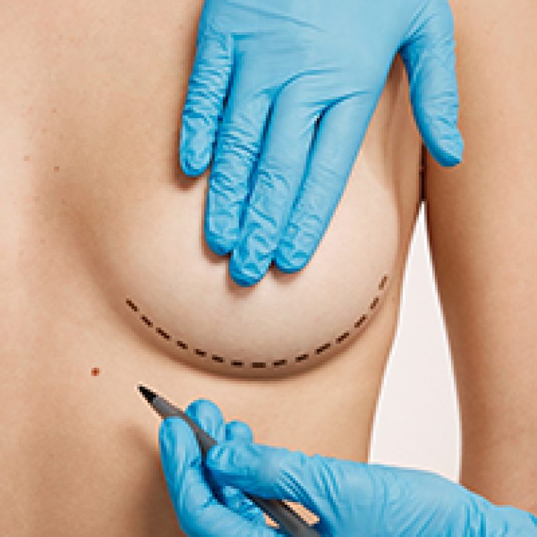 Woman being prepped for plastic surgery.