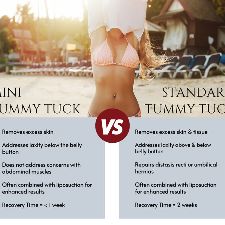 Mini Tummy Tuck comparison with Standard Tummy Tuck.